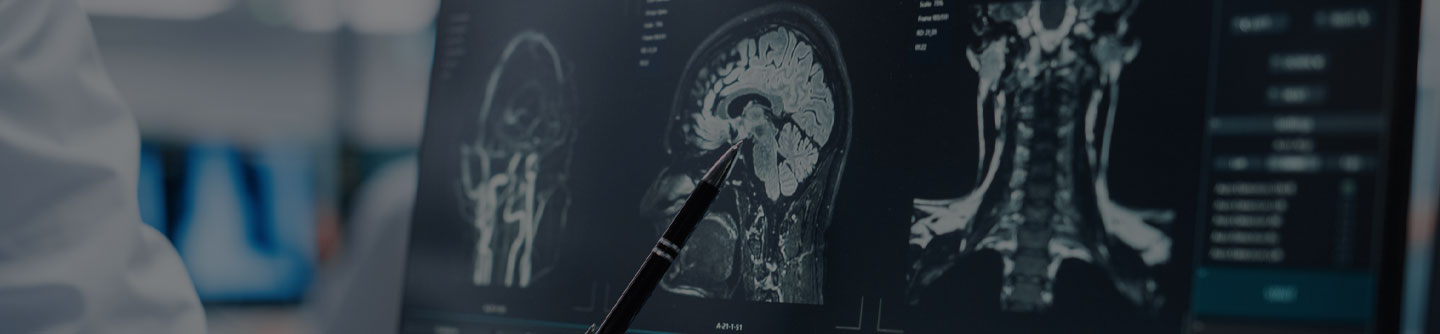 Traumatic Brain Injury Lawyers