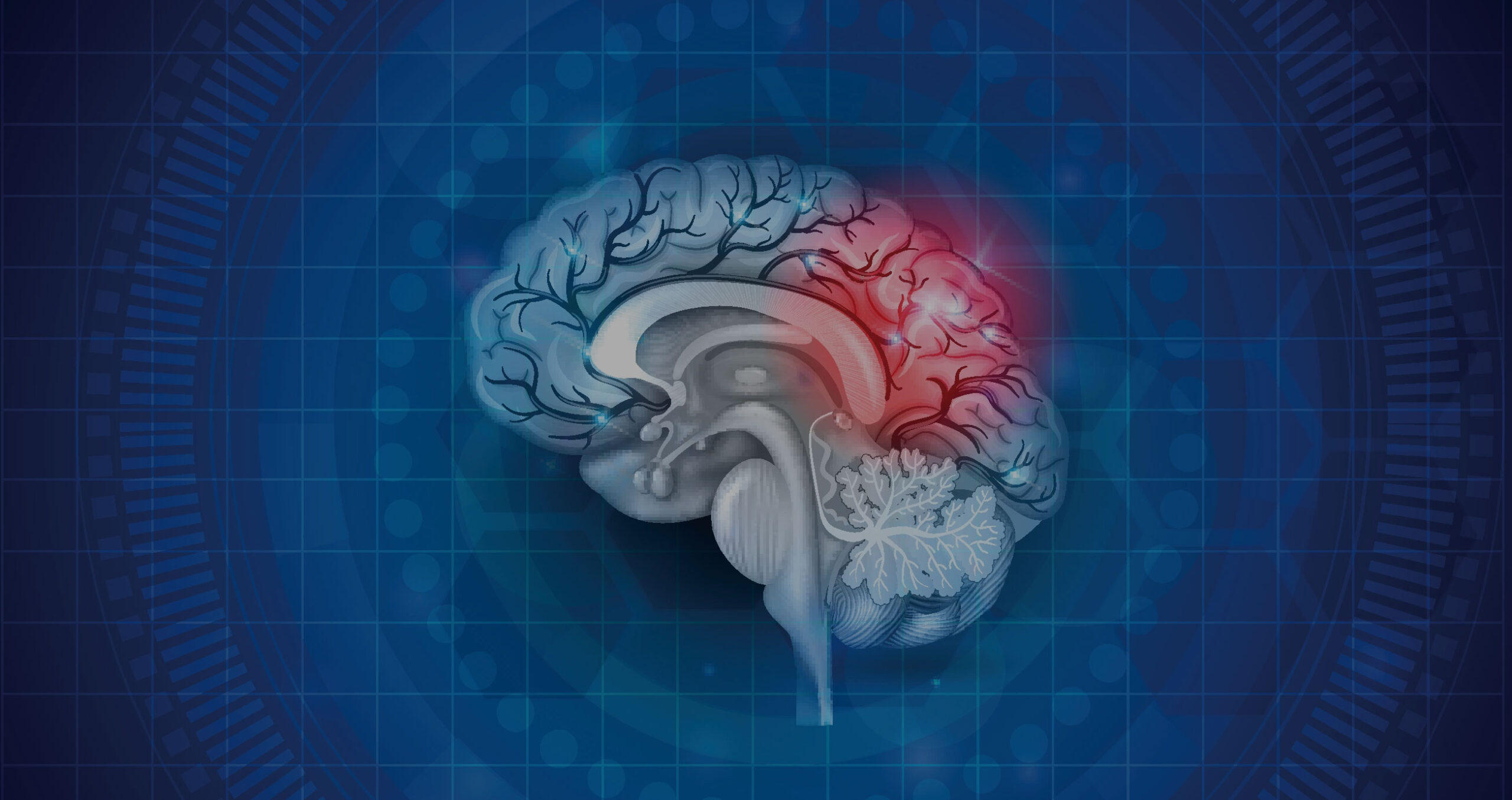 How AI Is Helping To Diagnose Concussions Jim Adler The Texas Hammer how-ai-is-helping-to-diagnose-concussions-jim-adler-the-texas-hammer