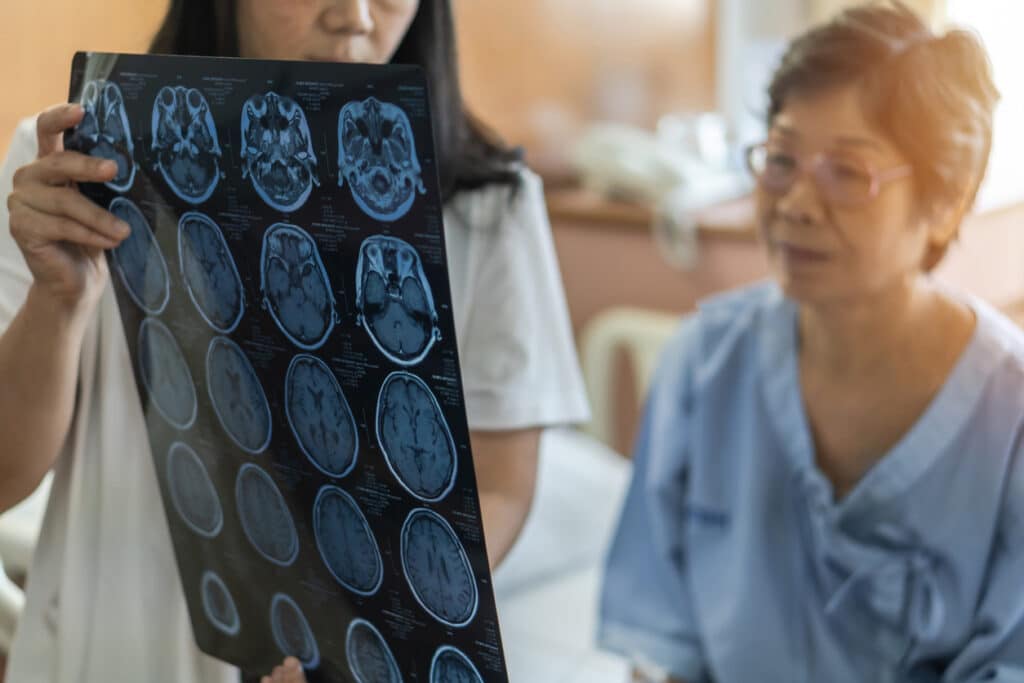 a doctor showing patient an x-ray of their brain
